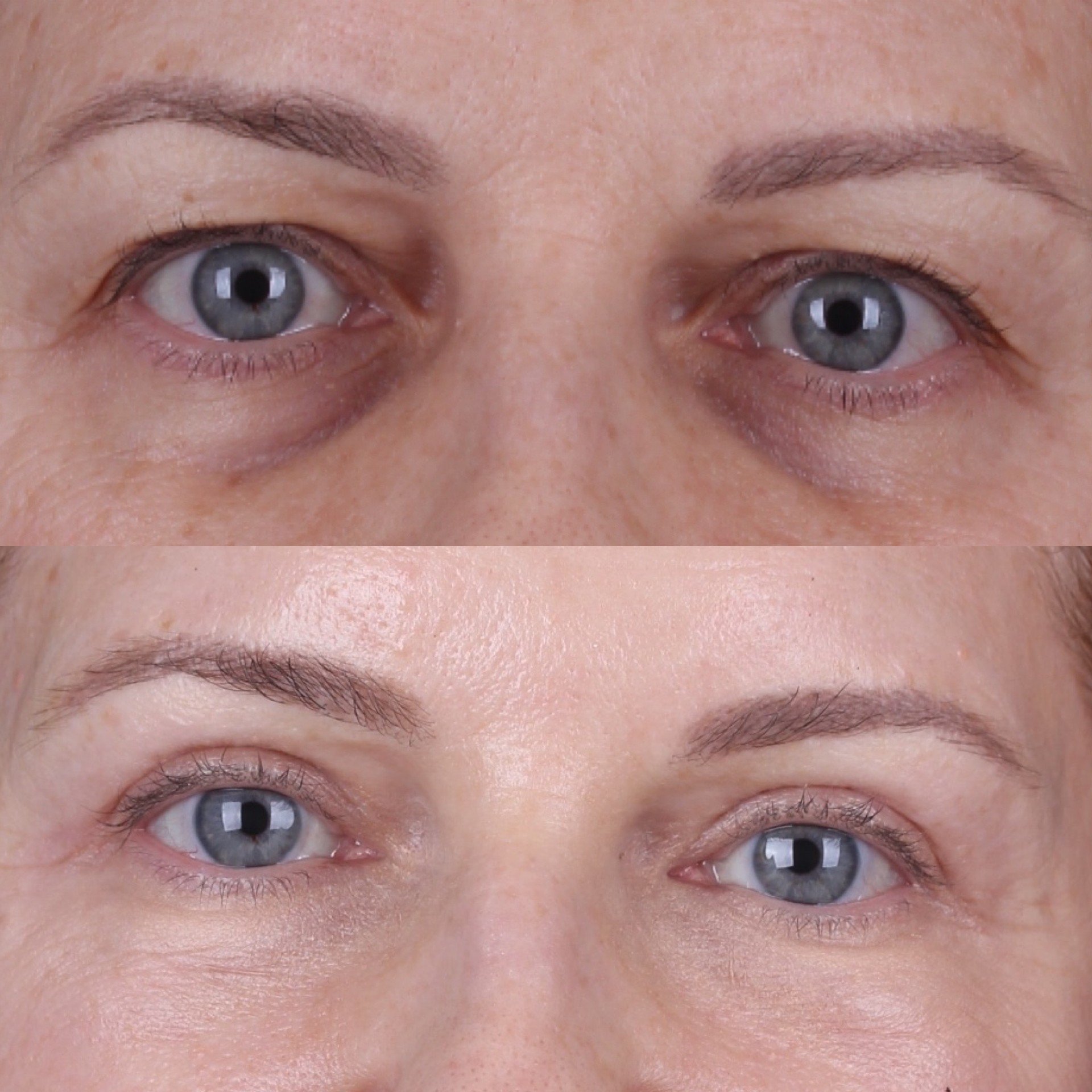 Real patient results before and after plastic surgery results in Beverly Hills, CA, performed by Dr. Moy