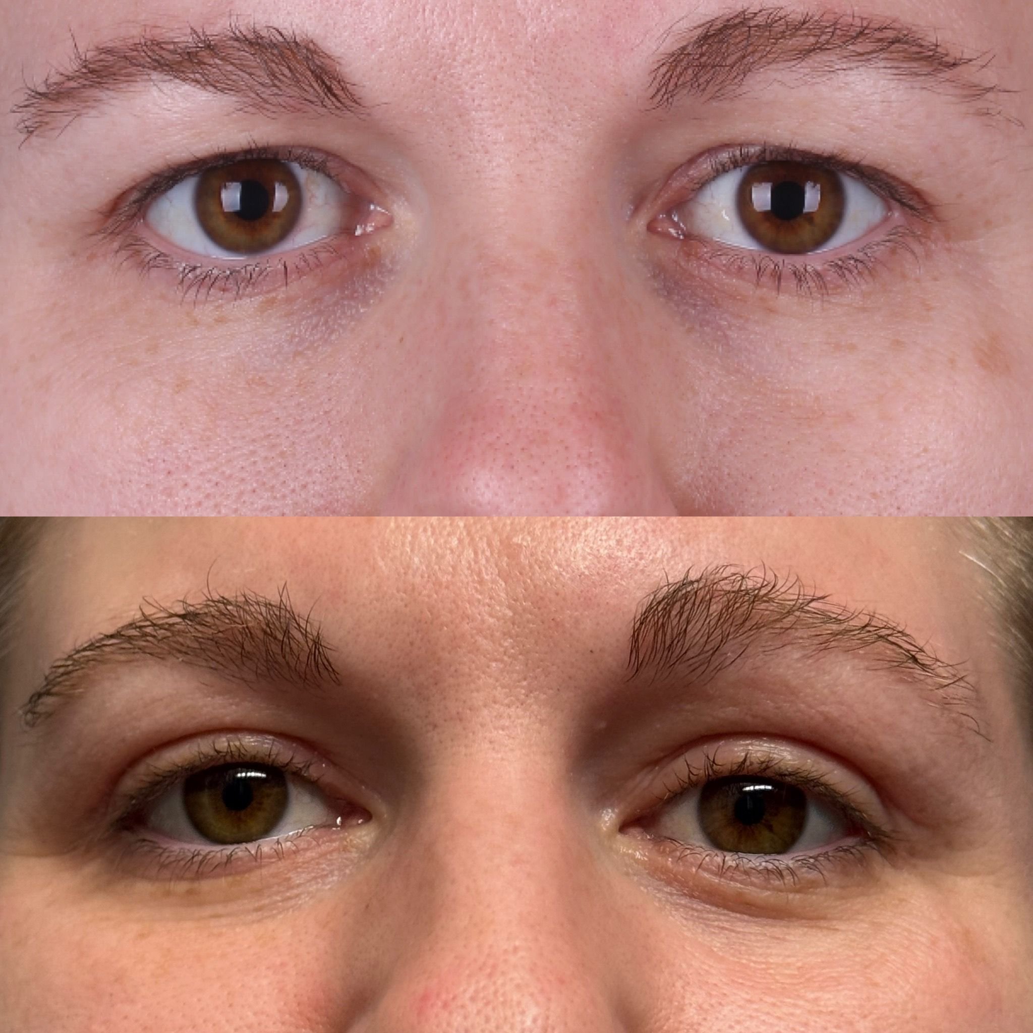 Real patient results before and after plastic surgery results in Beverly Hills, CA, performed by Dr. Moy