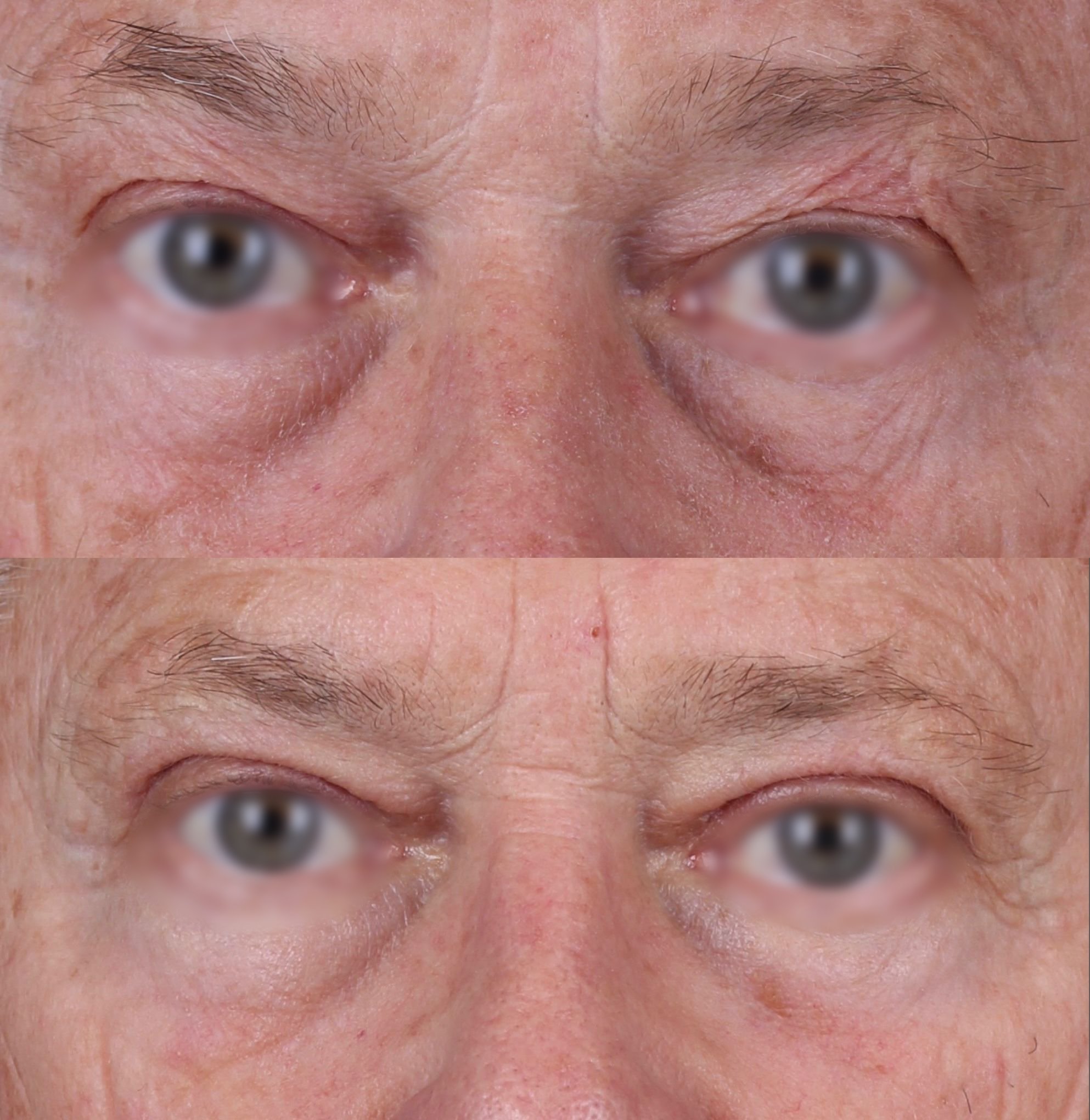Real patient results before and after plastic surgery results in Beverly Hills, CA, performed by Dr. Moy