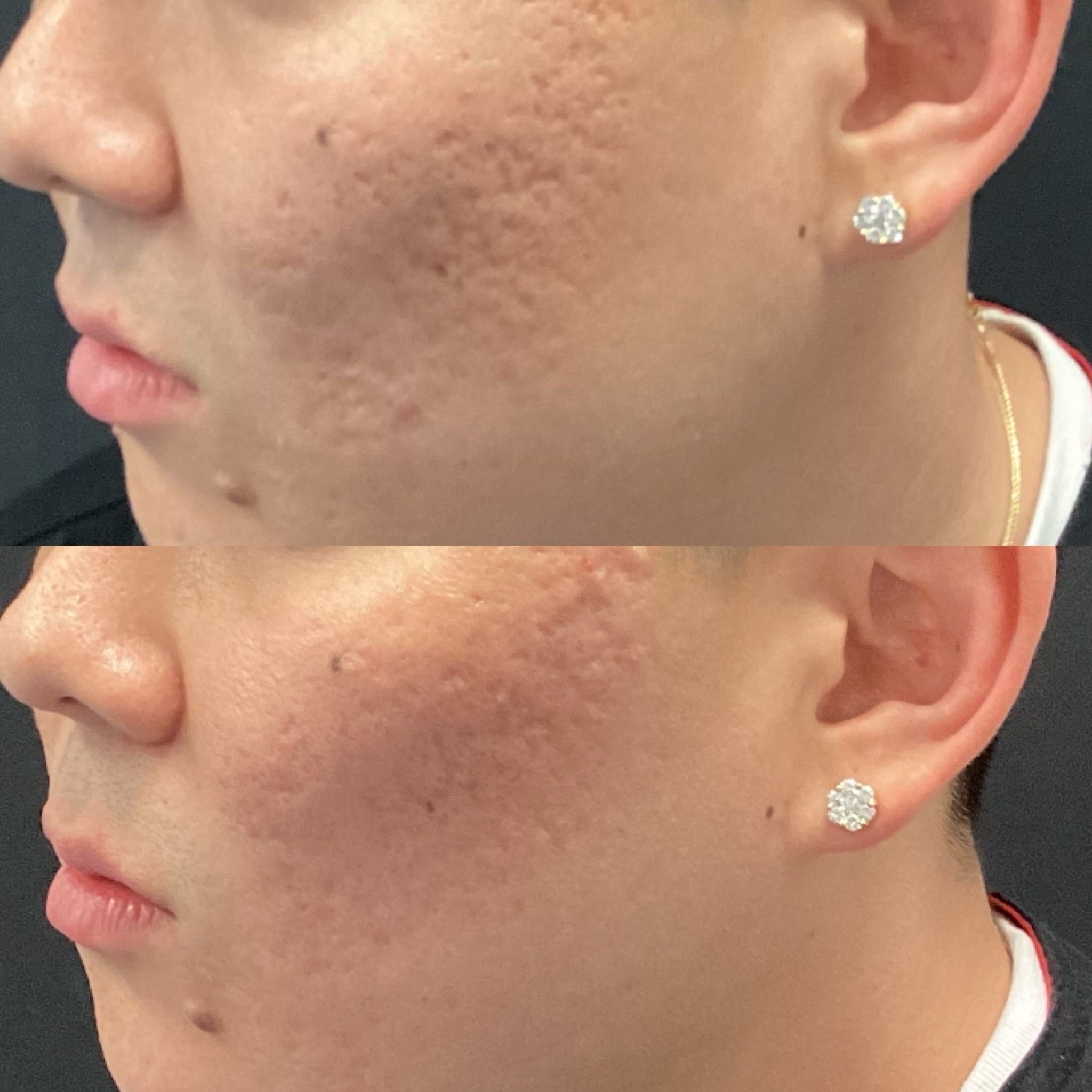 Real patient results before and after plastic surgery results in Beverly Hills, CA, performed by Dr. Moy