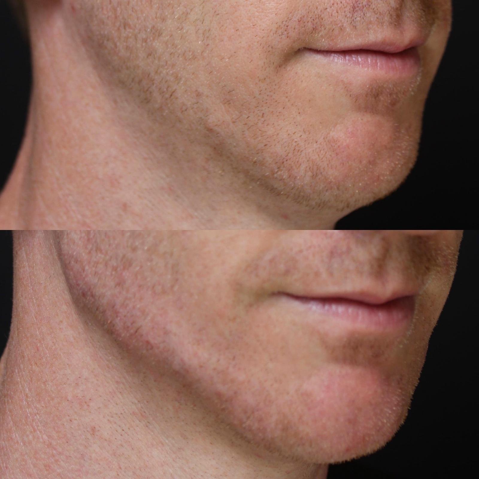 Real patient results before and after plastic surgery results in Beverly Hills, CA, performed by Dr. Moy