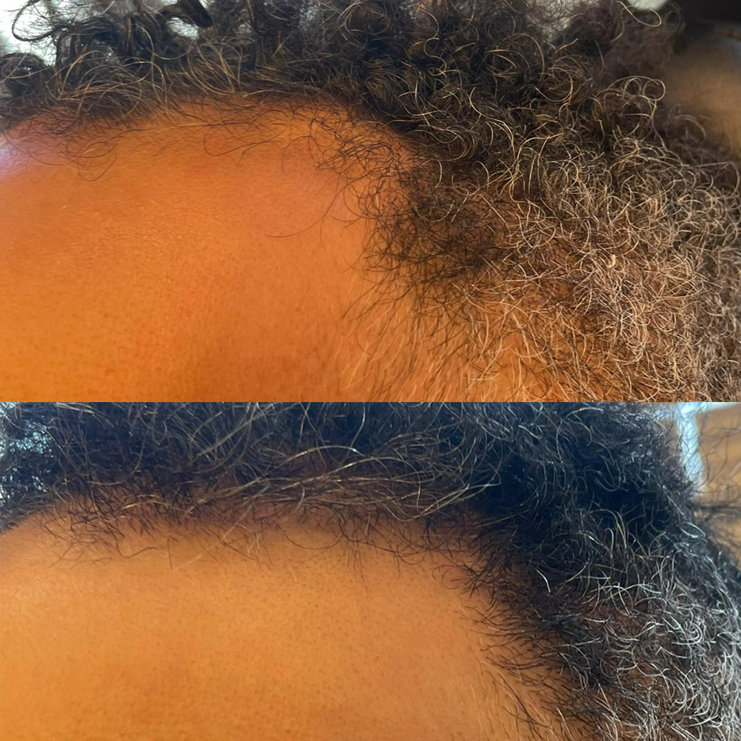 Real patient results before and after plastic surgery results in Beverly Hills, CA, performed by Dr. Moy