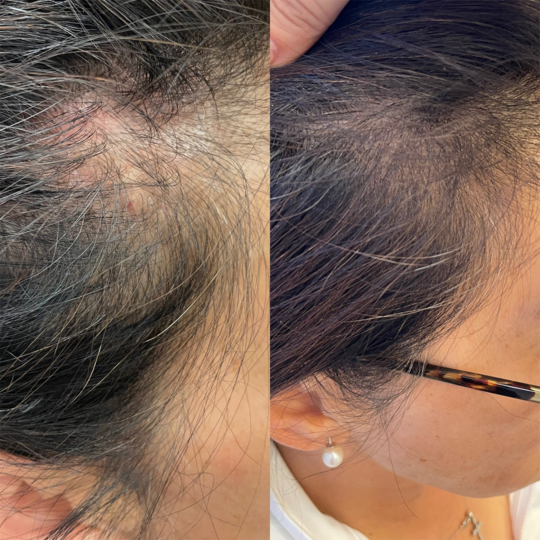Real patient results before and after plastic surgery results in Beverly Hills, CA, performed by Dr. Moy