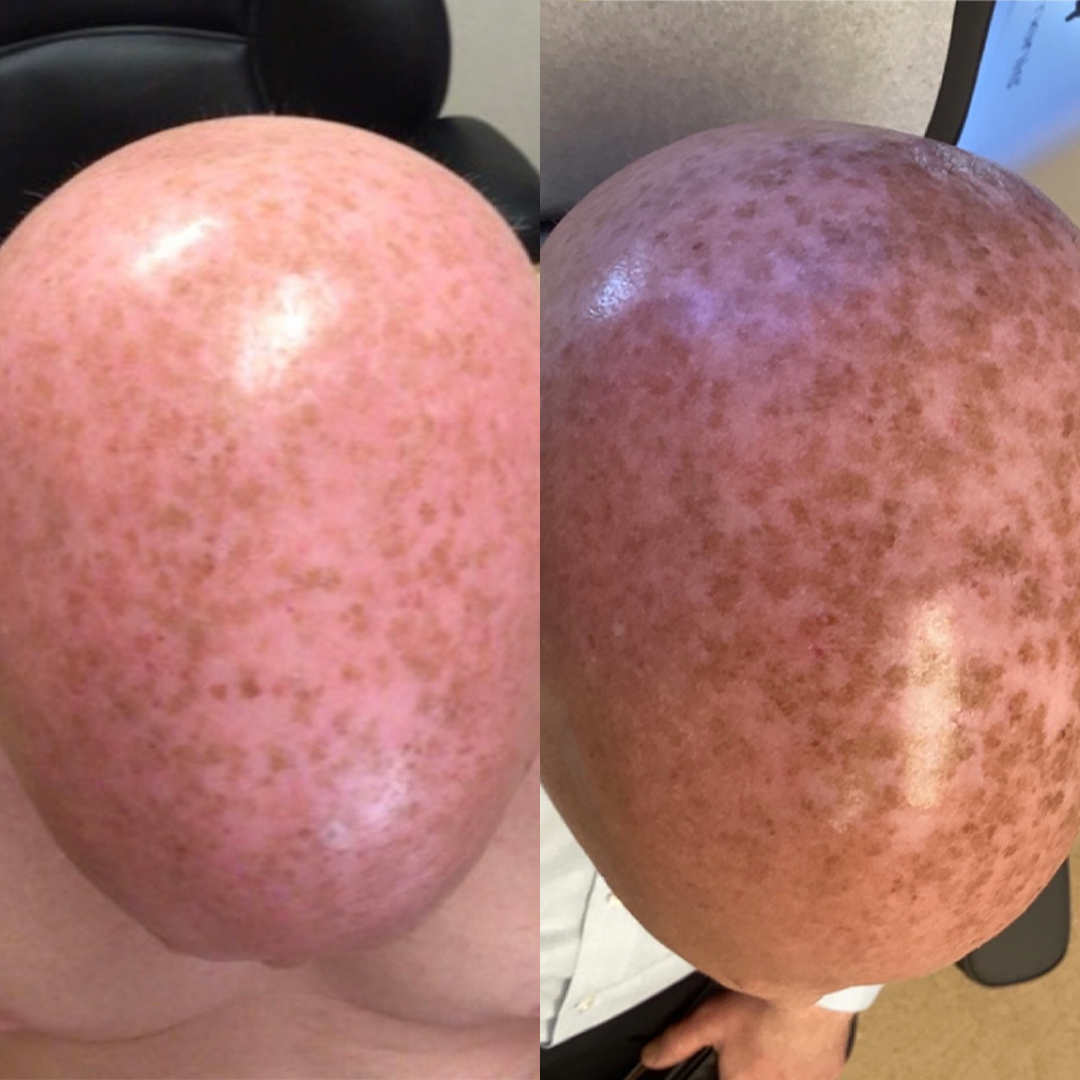 Real patient results before and after plastic surgery results in Beverly Hills, CA, performed by Dr. Moy