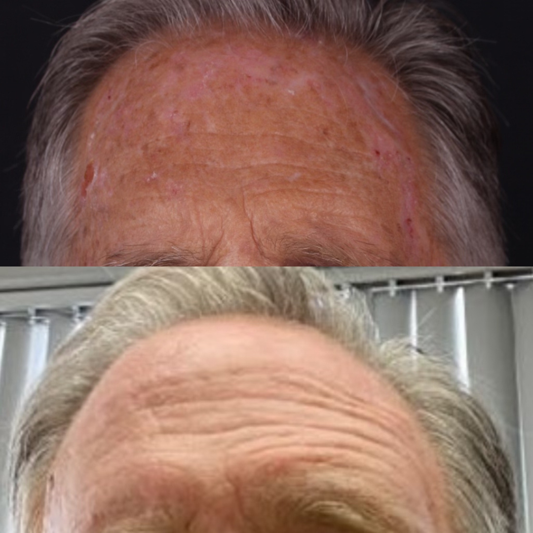 Real patient results before and after plastic surgery results in Beverly Hills, CA, performed by Dr. Moy