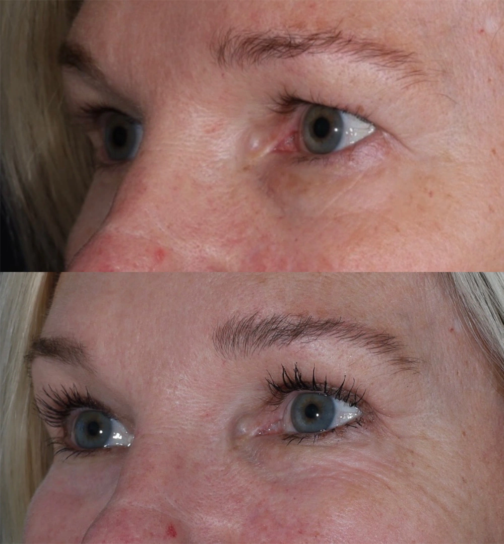 Real patient results before and after plastic surgery results in Beverly Hills, CA, performed by Dr. Moy