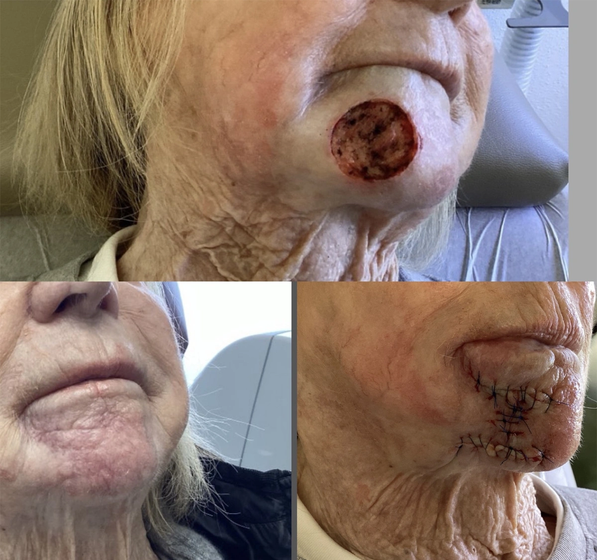 Real patient results before and after plastic surgery results in Beverly Hills, CA, performed by Dr. Moy