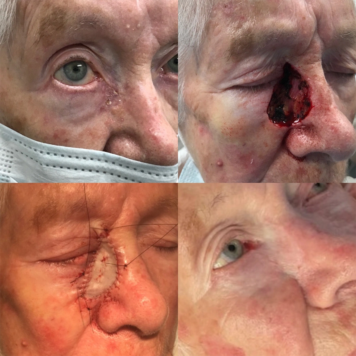 Real patient results before and after plastic surgery results in Beverly Hills, CA, performed by Dr. Moy