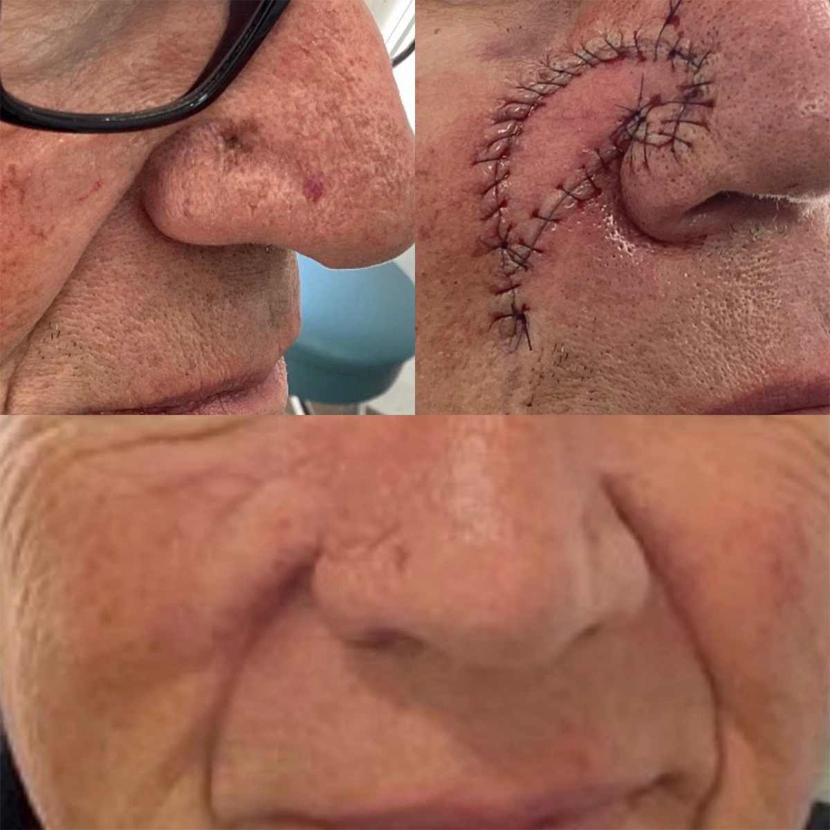 Real patient results before and after plastic surgery results in Beverly Hills, CA, performed by Dr. Moy