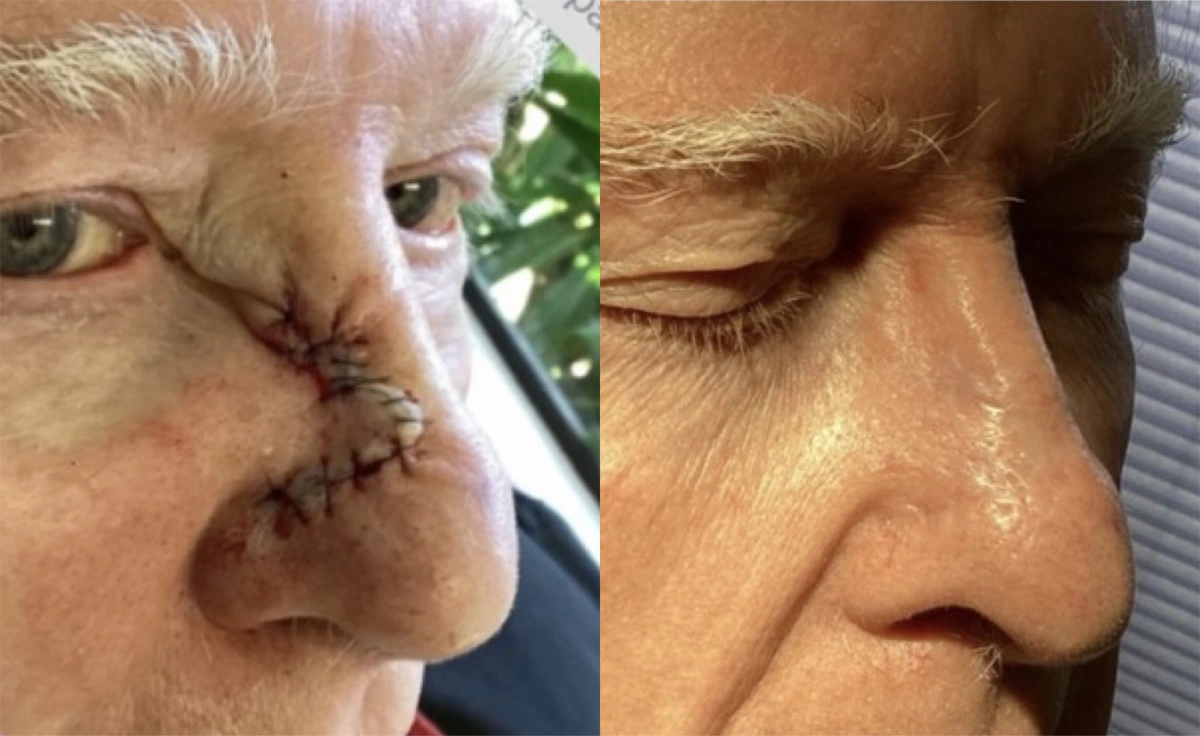 Real patient results before and after plastic surgery results in Beverly Hills, CA, performed by Dr. Moy