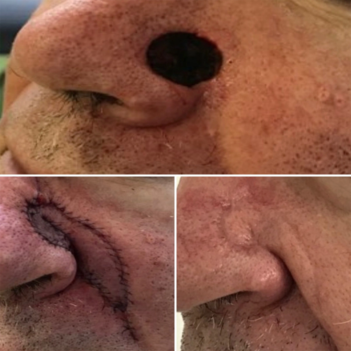 Real patient results before and after plastic surgery results in Beverly Hills, CA, performed by Dr. Moy