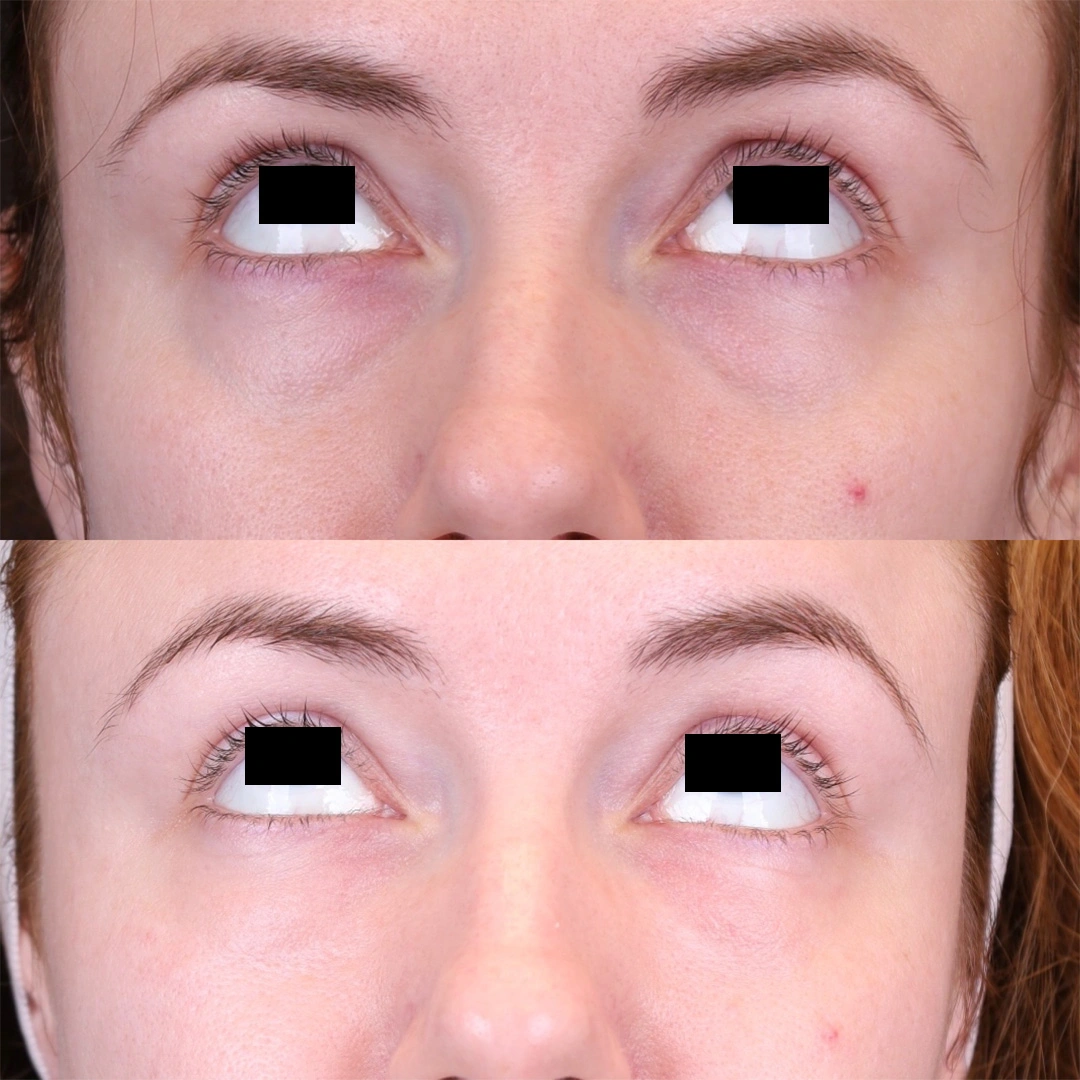 Rectangle 5-2